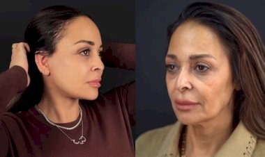 داليا البحيرى بعد عمليتها الأخيرة: ممتنة جدا لكل كلمة طبطبة وكل دعم